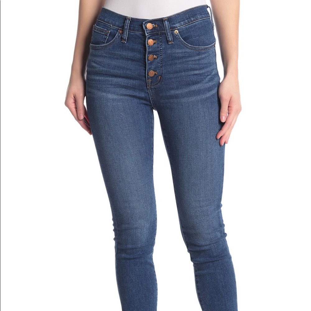 Madewell Button Fly Mid Rise Skinny